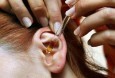 Применение камфорного масла для ушей